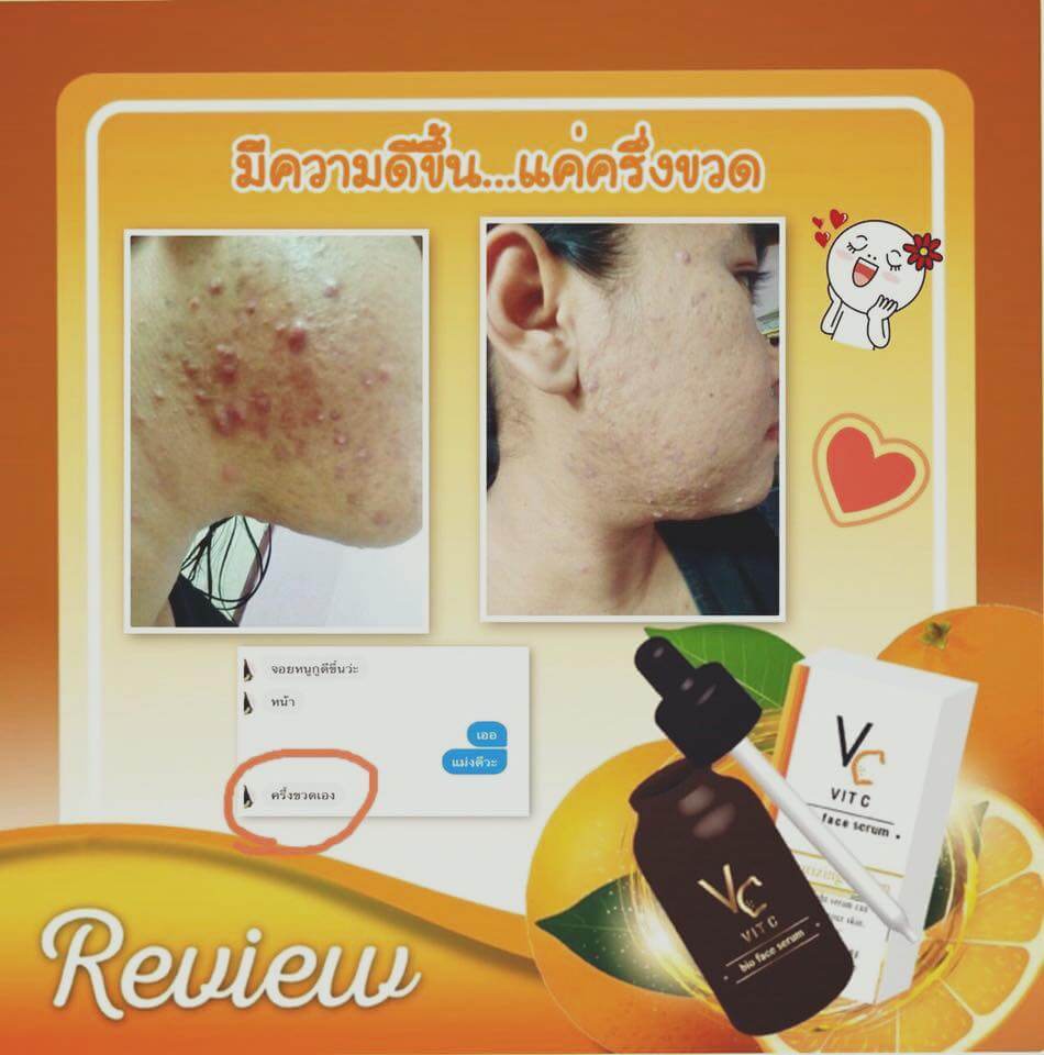 VitCBioFaceLotion ,VC ,VitC ,VitaminC ,น้ำใสๆแต่เด่นเรื่องบำรุง ,Serum VCเซรั่ม ,VCราคา,VCรีวิว,vit c bio face serum ของปลอม, vit c bio face serum วิธีใช้, vit c bio face serum ปลอม ,vit c bio face serum ดีไหม ,vit c bio face serum น้องฉัตร ,vit c bio face serum แพ้ ,vit c bio face serum first care serum 10ml ,vit c bio face serum ส่วนผสม ,vit c bio face serum - tity ,vit c bio face serum ใช้ดีไหม ,vit c bio face serum ,vit c bio face serum รีวิว ,vit c bio face serum ขายที่ไหน,vit c bio face serum ซื้อที่ไหน