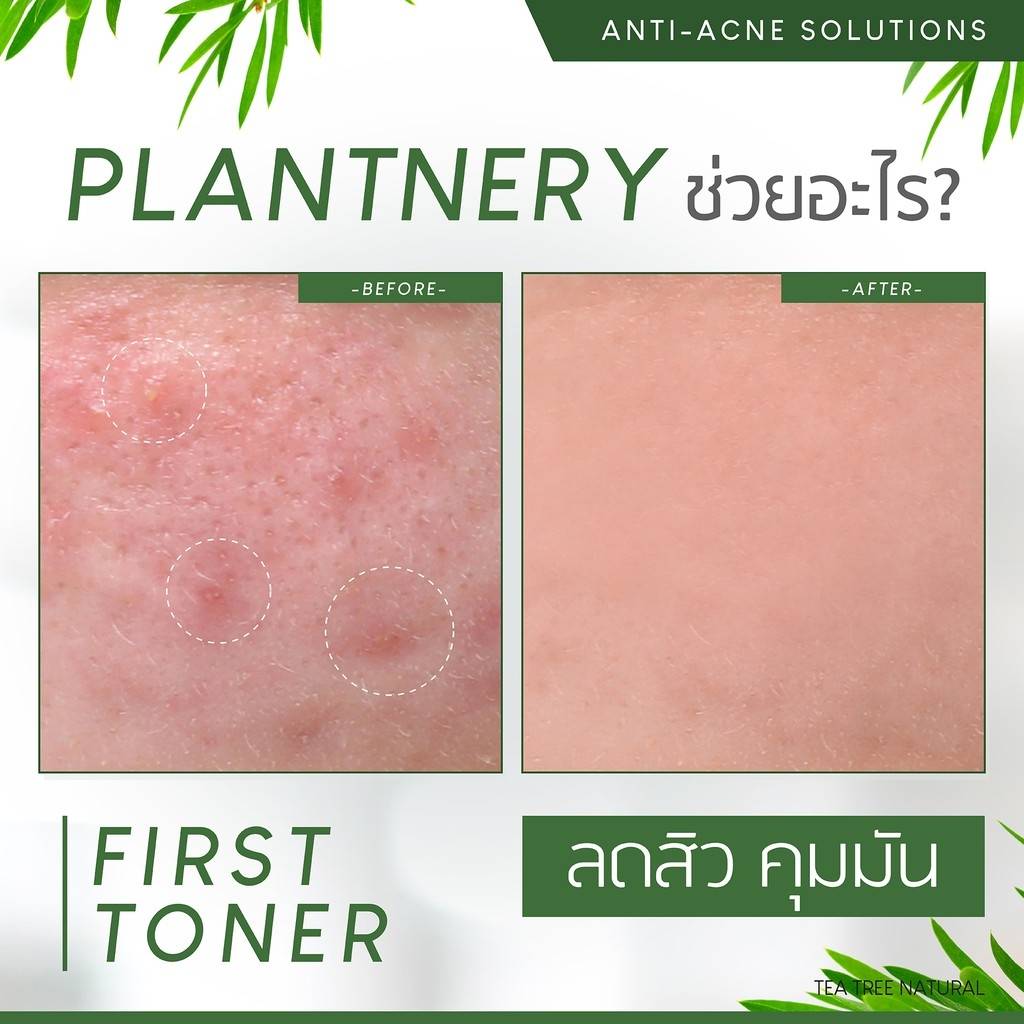 Plantnery Tea Tree First Toner 